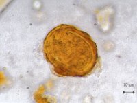 Hier sehen Sie die stark vergrößerte Darstellung eines Peitschenwurms unter dem Mikroskop.